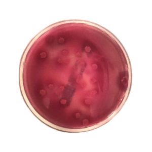 AGAR VRBD