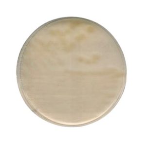 AGAR R2A