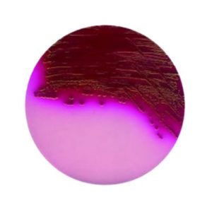 AGAR ENDO