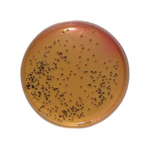 AGAR SS SALMONELLA SHIGELLA