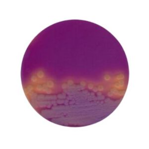 AGAR DEXTROSE PEPTONA DE CASEINA